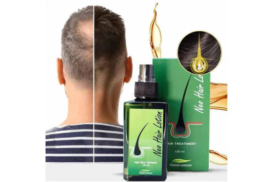 Benefits of Using Neo Hair Lotion